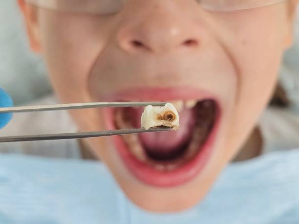 Best Emergency Root Canal Treatment in Rowland, NC